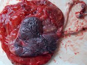La placenta: istruzioni per l&#039;uso!