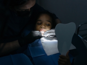 Sigillatura dei molari nei bambini, i pro e i contro