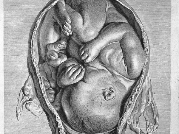 Avevi mai visto un feto nero? Ecco il white privilege svelato con un’immagine