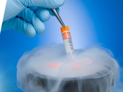 Cellule staminali per gli scompensi cardiaci