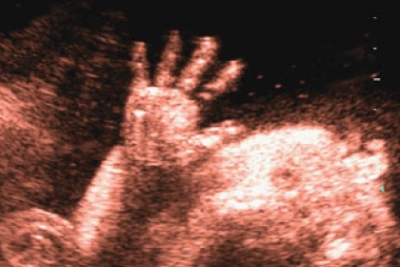 Ecografia o fotostoria della gravidanza?