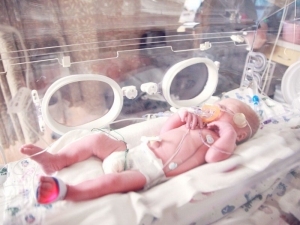 La maggior parte dei bambini nati prematuri cresce senza problemi