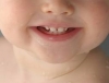 Dentini che spuntano, come gestire i disturbi