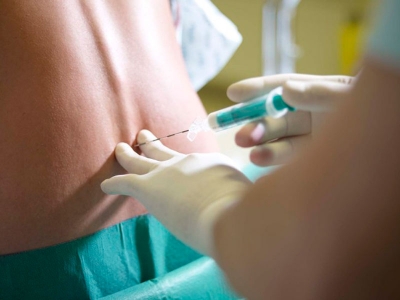 Epidurale si, epidurale no...