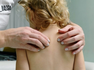 Scoliosi nei bambini: i sintomi e la prevenzione