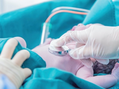 La Sindrome di Cockayne: cosa c'è da sapere